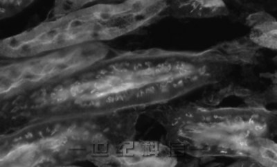 小鼠肾脏荧光图像(单色)的比较 使用传统模型“DS-Ri2”获取图像