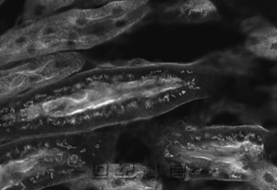 小鼠肾脏荧光图像（单色）的比较 使用常规模式“Digital Sight 10”获取图像