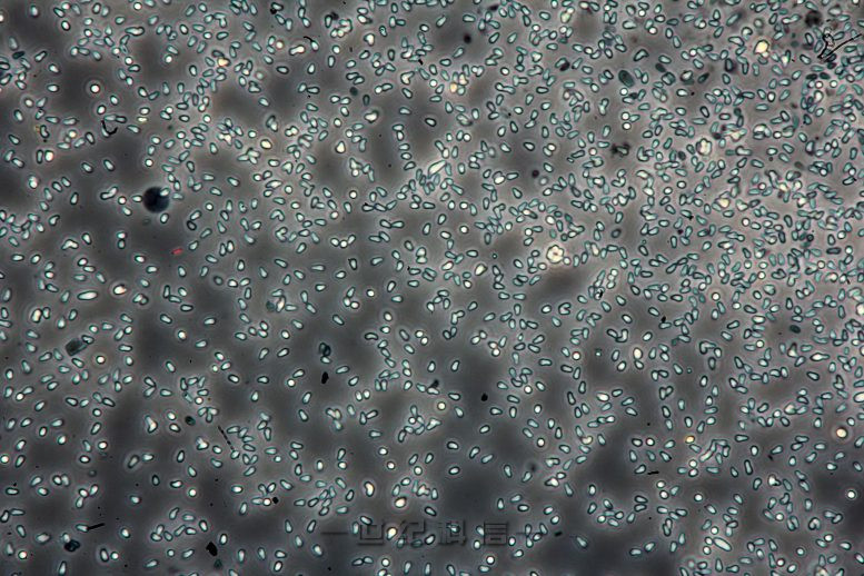 水蚤寄生虫 Ordospora 孢子